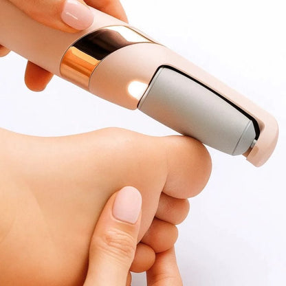 Electric Callus Remover – Smooth, Soft &amp; Beautiful Feet at Home